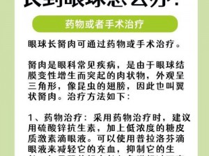 超级胬肉系统——一种专业的胬肉治疗设备