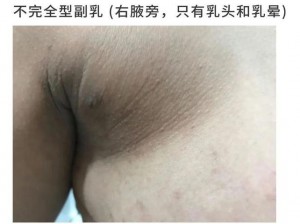 厨房里两只乳头被吸肿了;厨房里两只乳头被吸肿了，丈夫的惊人之举