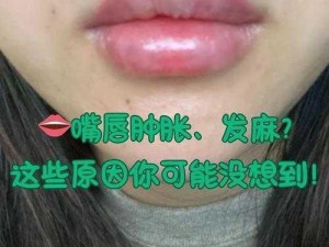 小嘴无力合拢红肿外翻-小嘴无力合拢红肿外翻，这是怎么了？