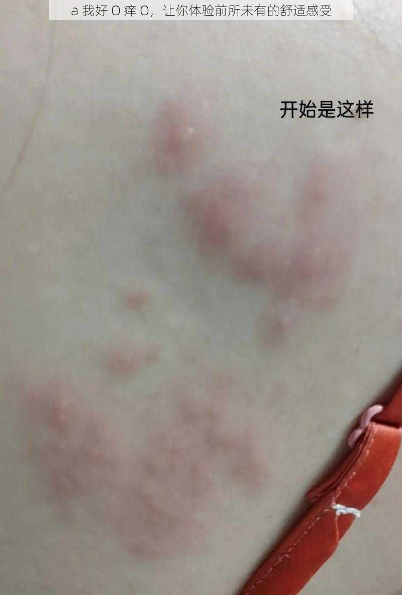 a 我好 O 痒 O，让你体验前所未有的舒适感受