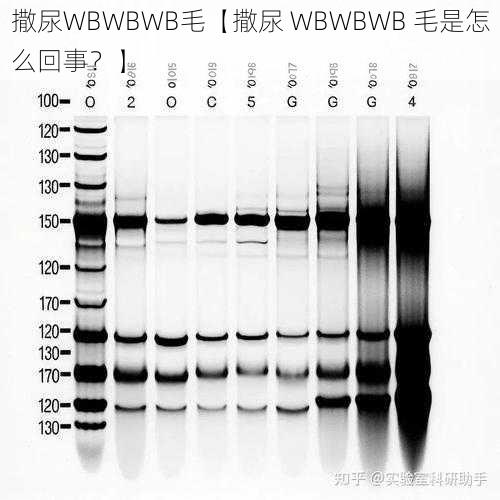 撒尿WBWBWB毛【撒尿 WBWBWB 毛是怎么回事？】